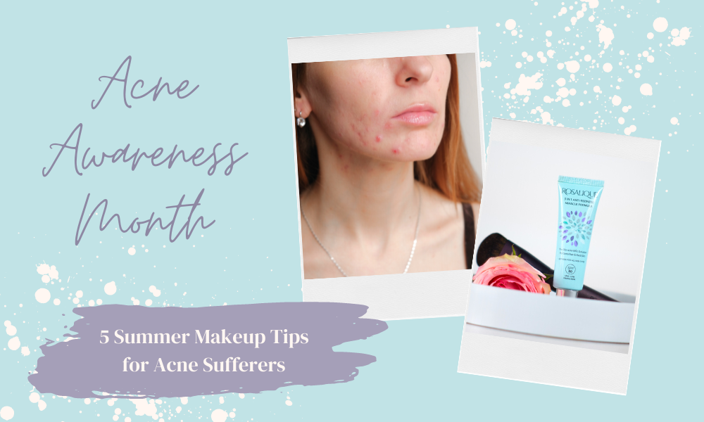 Five Summer Makeup Tips for Acne Sufferers