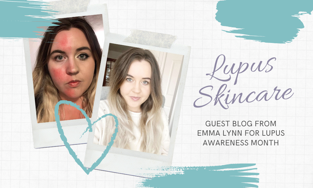 Lupus Skincare Tips from Emma Lynn